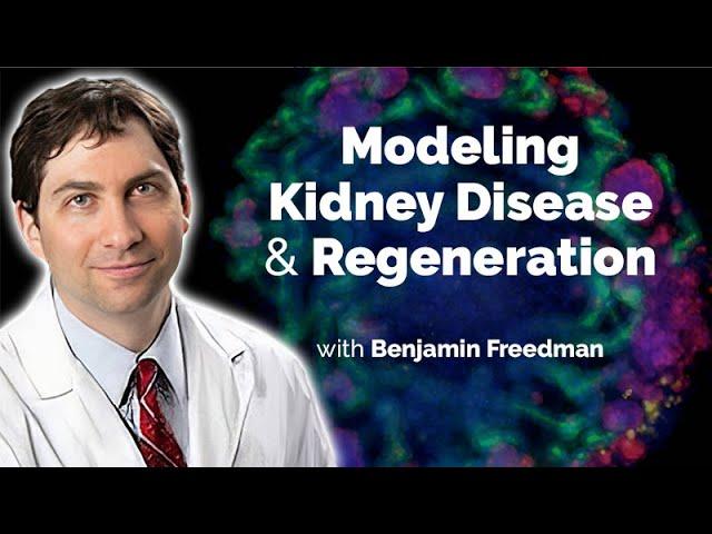 Modeling Kidney Disease and Regeneration with Organoids Derived from Human Pluripotent Stem Cells