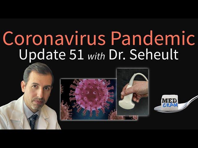 Coronavirus Pandemic Update 51: State by State Projections; Ultrasound to Diagnose COVID19 Pneumonia