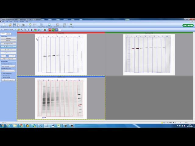 Total Protein Normalization - Advanced Tutorial