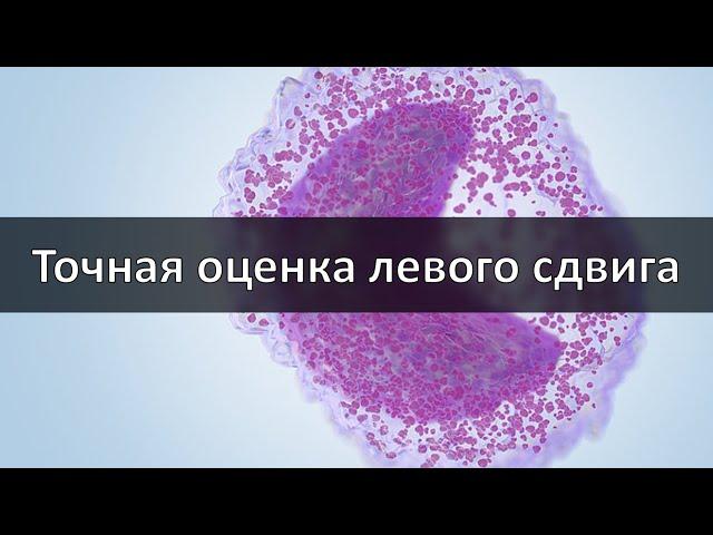 Точная оценка левого сдвига в современном анализе крови. Палочки или новые технологии?