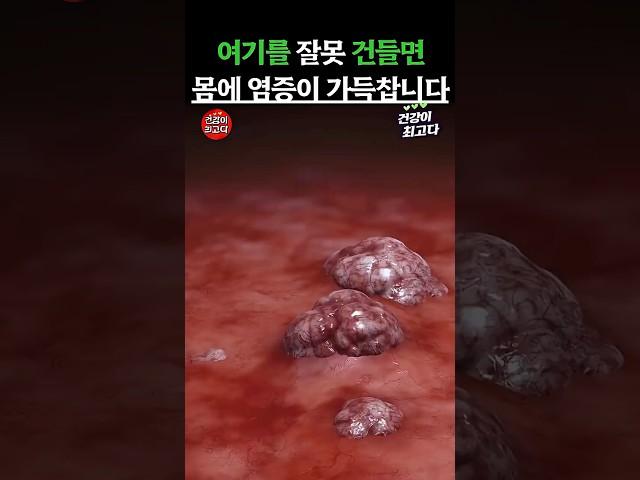여기를 잘못 건들면 몸에 염증이 가득 찹니다 #건강정보 #건강