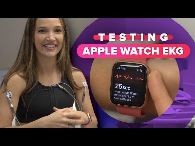 The Apple Watch ECG found something unexpected about my heart