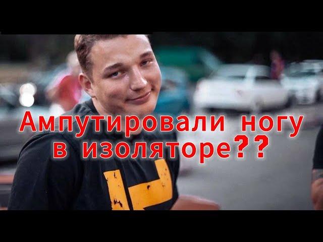 Эдварду Билу ампутировали ногу!?