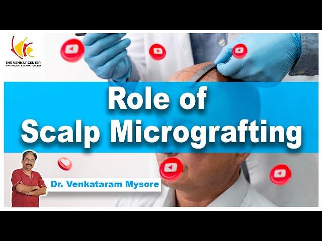 The Role of Scalp Micrografting | Dr. Venkataram Mysore | The Venkat Center, Bengaluru