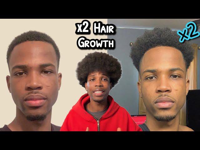 How To Double Your Hair Growth In Half The Time  ( For Men With Short Hair )