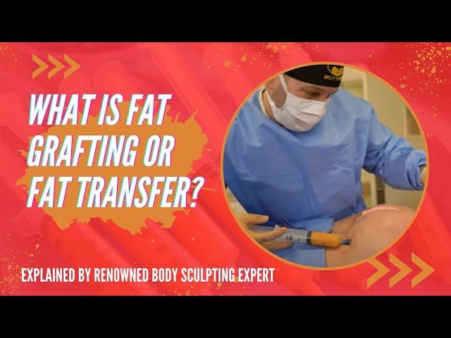 What is Fat Grafting or Fat Transfer? Explained by Renowned Body Sculpting Expert Dr. Jason Emer MD