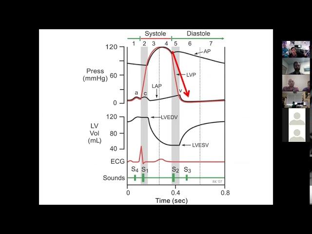 Diastolic Dysfunction 1
