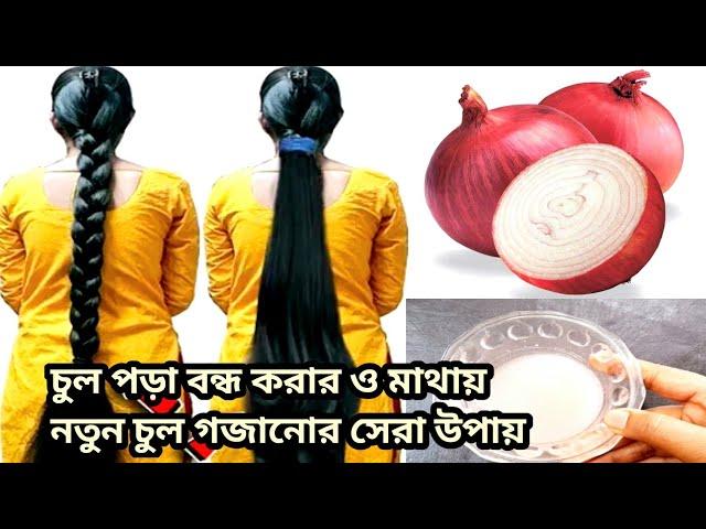 অতিরিক্ত চুল পড়া বন্ধ করার ও মাথায় নতুন চুল গজানোর ১০০% কার্যকরী উপায় / Hairfall solution