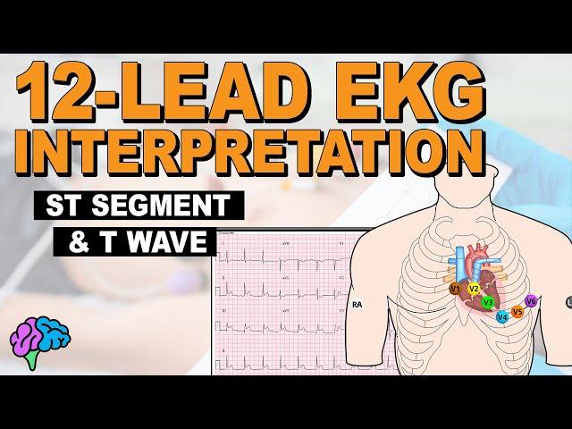 The ST Segment and T Wave REVIEW