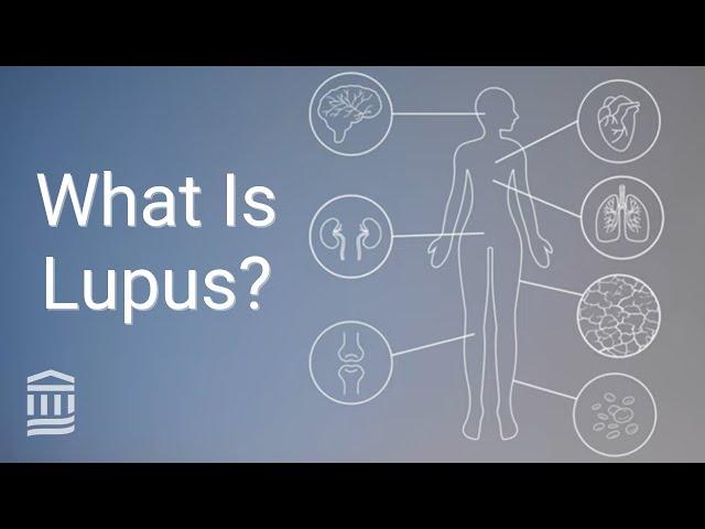 Understanding Lupus: Causes, Symptoms, Treatment, and Flare Ups | Mass General Brigham