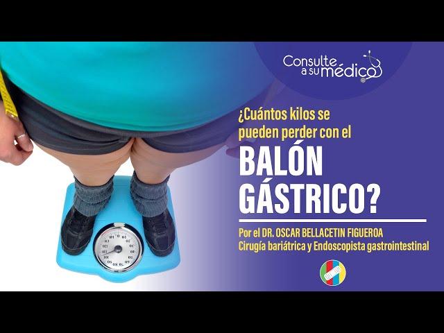 ¿Cuántos kilos se pueden perder con el balón gástrico?