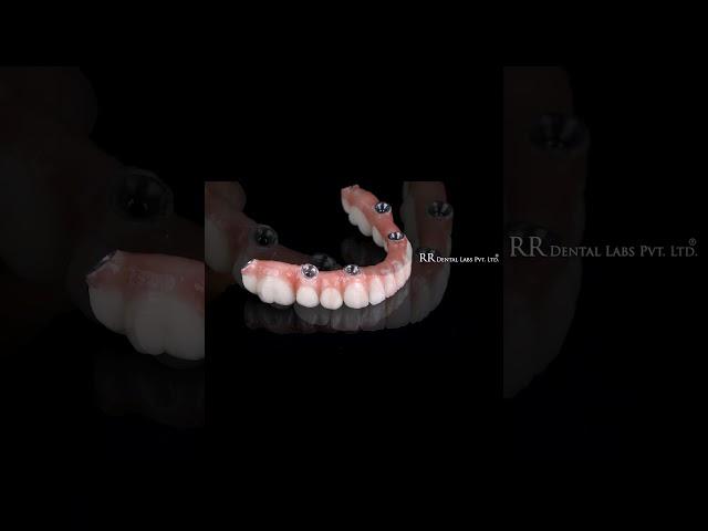 Revolutionizing Dental Technology Fire & Forget, I-Dent Aligners by RR Dental Labs India