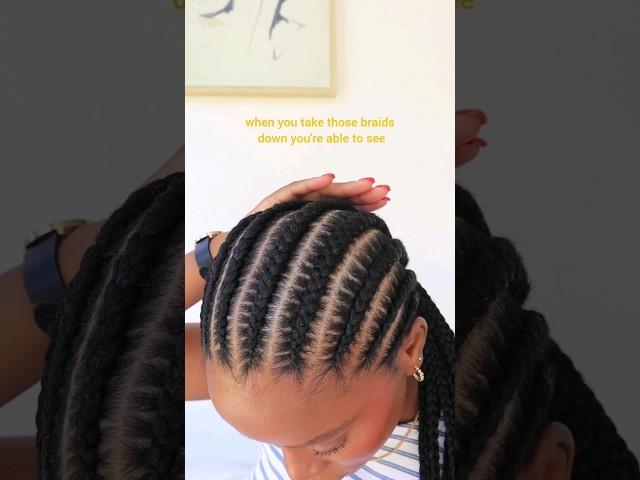 Can cornrows grow my natural hair.Hair growth & Length retention #naturalhair  #protectivehairstyles