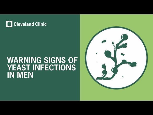 Warning Signs of Penile Yeast Infections