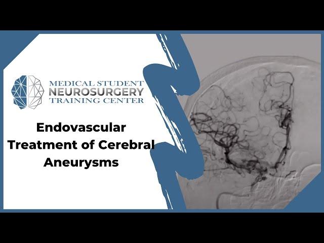 Endovascular treatment of Cerebral Aneurysms