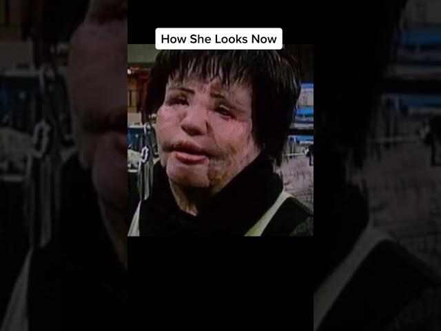 How people look before and after plastic surgery #shorts