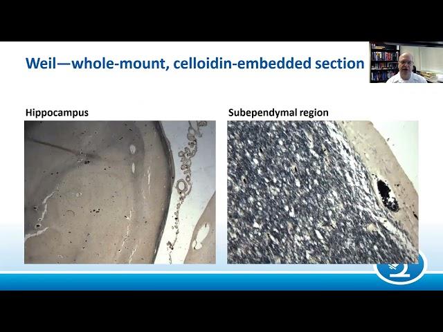 AANP Teaching Rounds - May 23 - General Neuroanatomy/Staining: An Introduction to Neuropathology