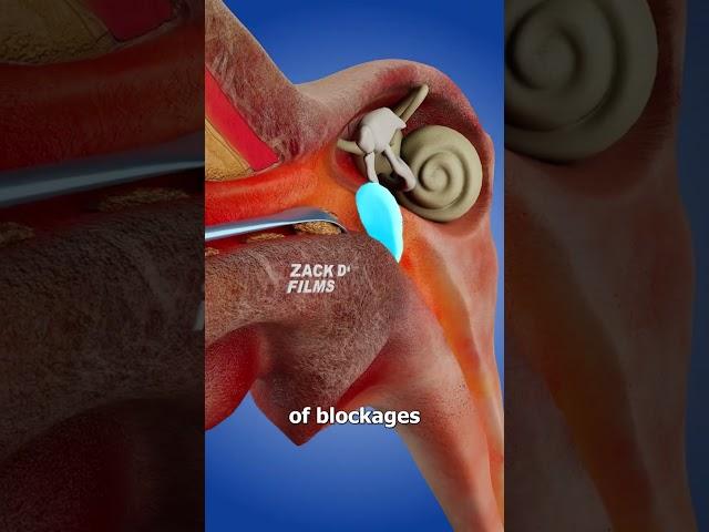 How Ear Spoons Work 