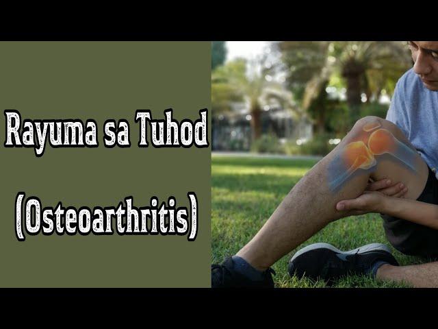 Exercise para sa RAYUMA sa tuhod. (Part 2) | House Physiotherapy