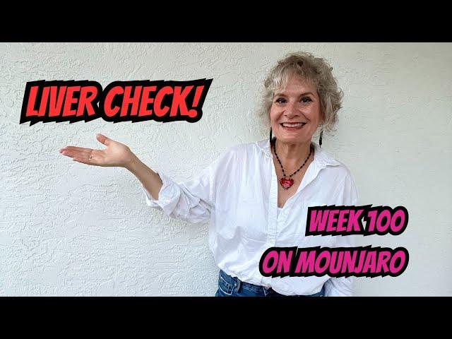 Week 100 on Mounjaro for Type 2 Diabetes: Results of a FibroScan for Non-Alcoholic Liver Disease