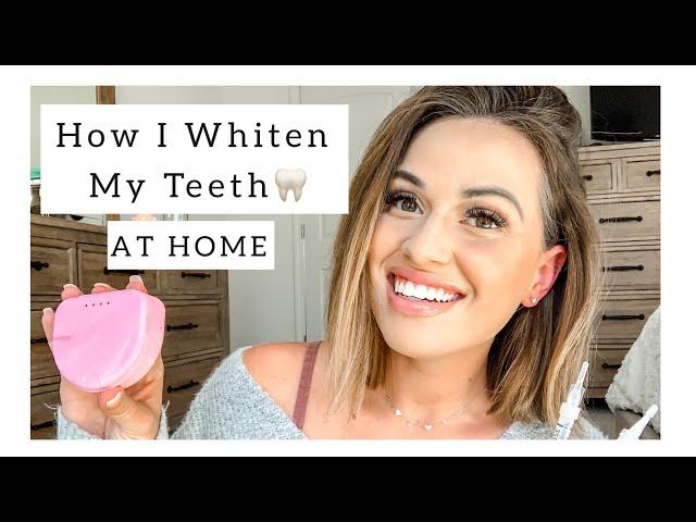 HOW I WHITEN MY TEETH  AT HOME |dental assistant | LEANNA MICHELLE