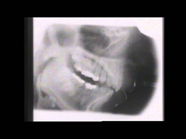 Kevin Munhall Xray Database 3