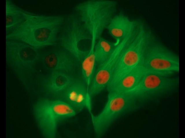 ZEISS Axio Observer: LLC PK1 cell culture, 3 channel time lapse fluorescence microscopy