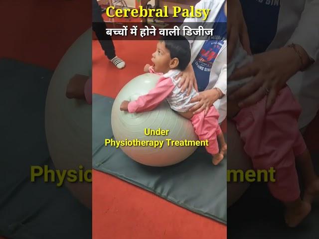 (सेरेब्रल पाल्सी) Cerebral Palsy  #physiodrdeepaksoni #cerebralpalsy