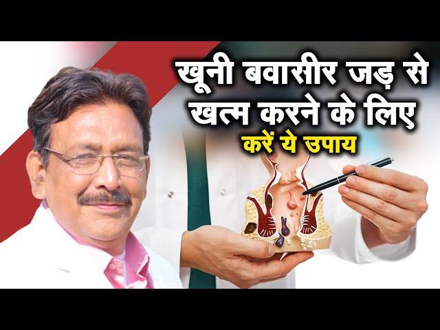 खूनी बवासीर जड़ से खत्म करने के लिए करें ये उपाय | Hakim Suleman khan | Sadhna Tv