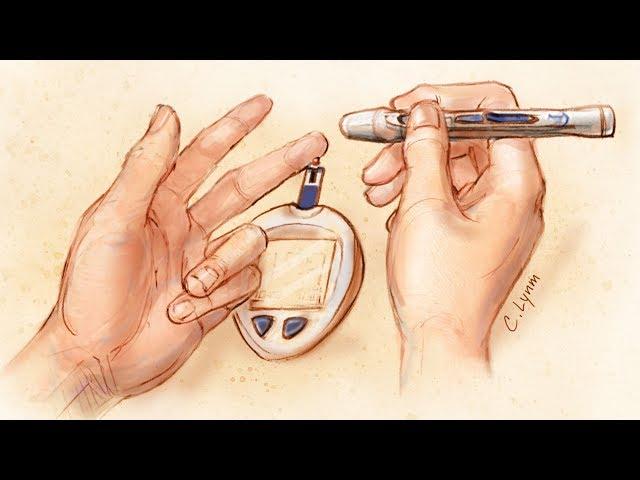 Glucose Self-monitoring in Non–Insulin-Treated Patients With Type 2 Diabetes