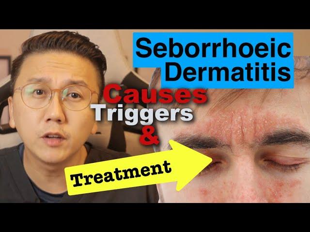 Seborrhoeic Dermatitis - Causes, Triggers & Treatment Options