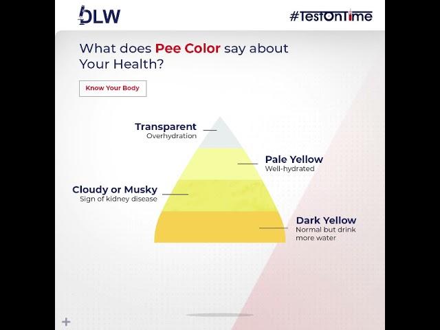 Urine Color Chart | Devansh Lab Werks