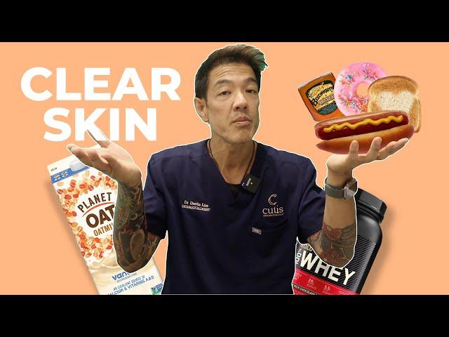 How your Diet and Gym Habits are causing Acne | Dr Davin Lim