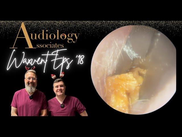 SKIN PLUG REMOVAL FROM EAR CANAL - WAXVENT 18