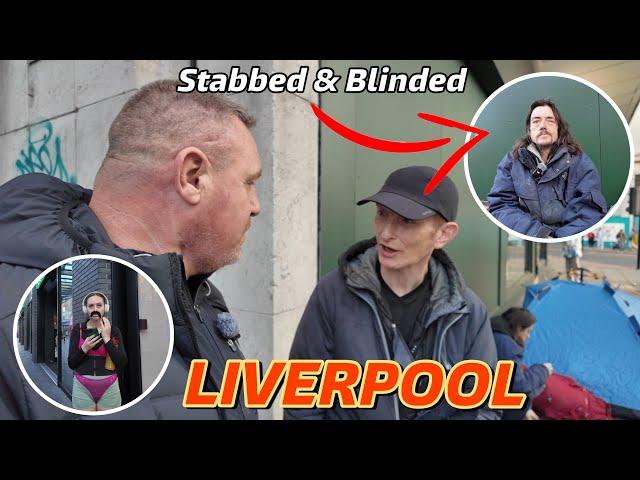 LIVERPOOL- STABBED in the EYE and now totally BLIND!!