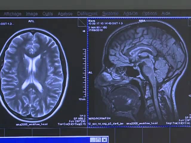 Top brain research centre opens in France