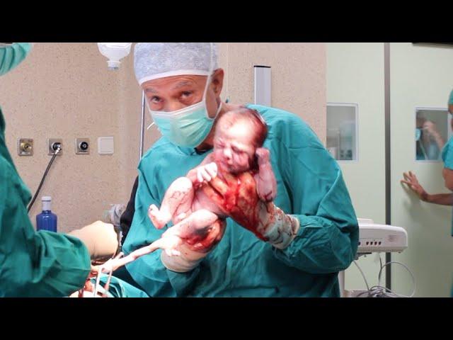  Live #caesarean birth of twins. Watch the father’s face 