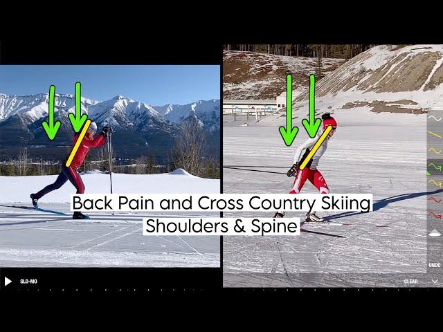 Back Pain and Cross Country Skiing: Shoulders & Spine