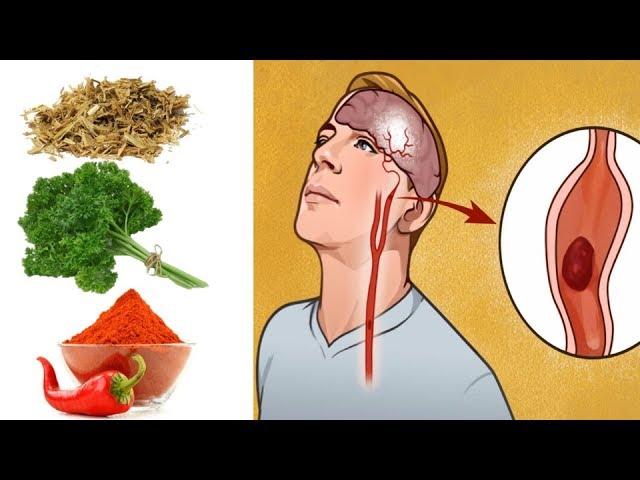 6 Herbs That Unclog Arteries & Improve Blood Circulation