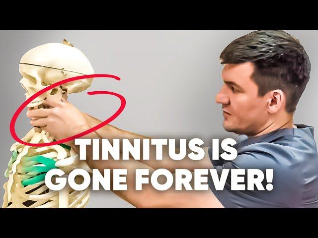 3 main causes of tinnitus. Did this and everything passed!