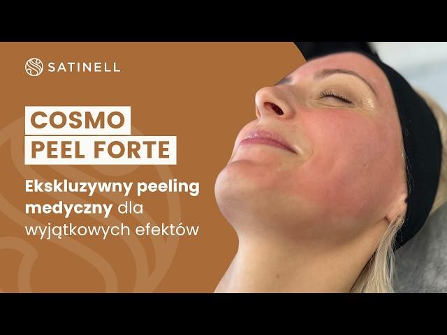 Cosmo Peel Forte - na fotostarzenie!