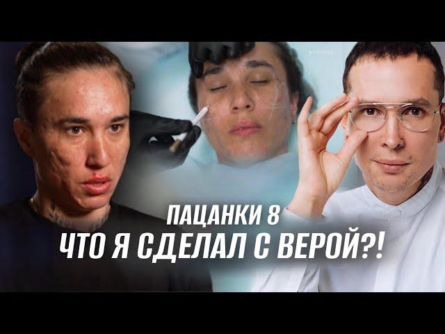 Что я сделал с Верой?! ПАЦАНКИ | Огромные рубцы постакне #пацанки8