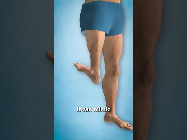 The Surgery That Turns Legs Around Surgeon Reacts
