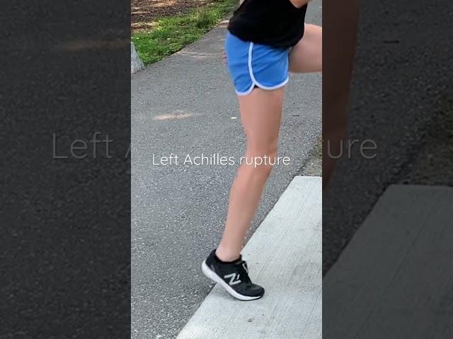 Achilles Tendon Rupture Caught on Camera