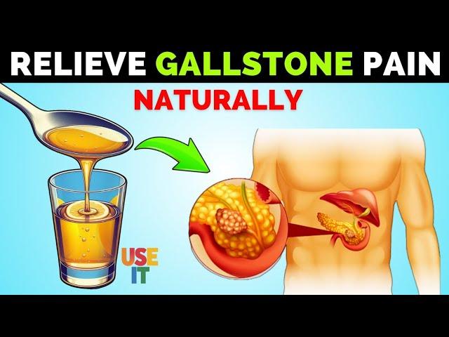 Quick Relief from Gallstones Pain: Try 5 Home treatment"