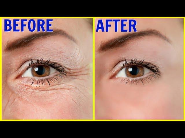 Only 3 days, how to remove "Wrinkles" | How to get rid of wrinkles