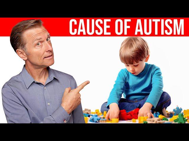 The REAL Cause of Autism Revealed: Dr. Berg Explains