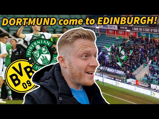  THE LAST SCOTTISH TEAM LEFT IN EUROPE! Hibernian v Dortmund