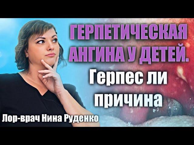 Герпетическая ангина у детей