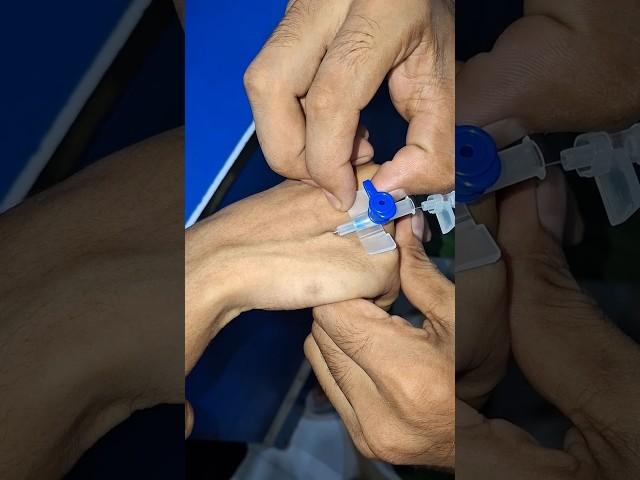 iv cannula proceed #part16